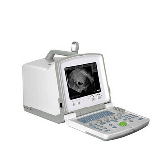 全数字超声妇产科手术监视仪 WED-390