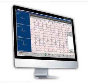 动态心电图分析系统 Cardio 8000