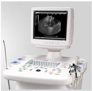一体式超声引导妇科宫腔手术仪 EMP-5500