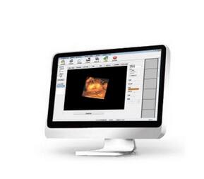 超声影像管理系统 MG系列