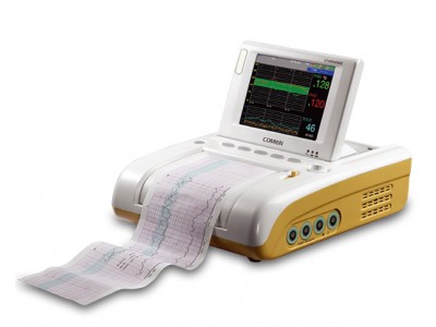STAR5000E胎儿监护仪产科单胎双胎监护仪