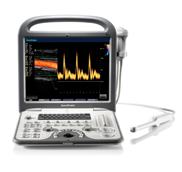 S6 便携式彩色超声诊断