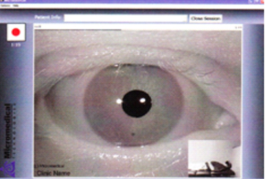 Euroclinic视频眼震电图仪ED600