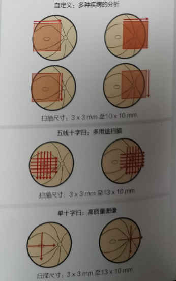 相干断层扫描仪2.png