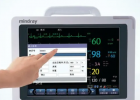 心脏监护仪：守护生命的准确指标监测
