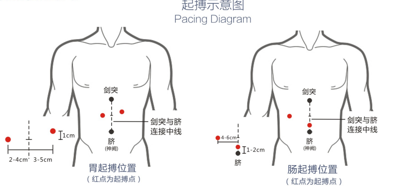 胃肠动力治疗仪