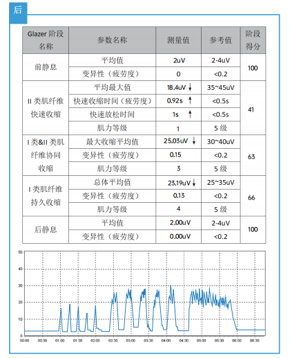 盆底康复