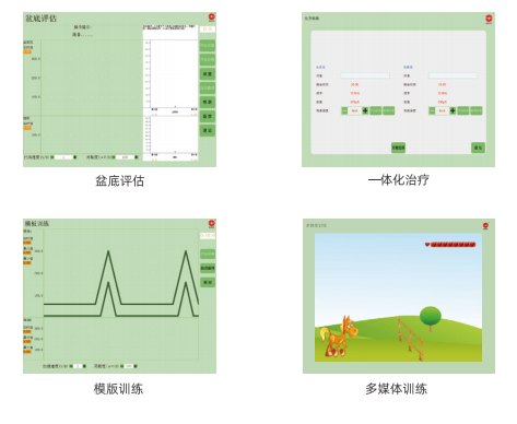 盆底康复治疗仪