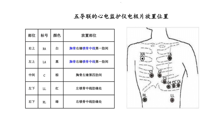 心电监护.jpg