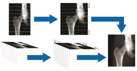 骨密度测量仪