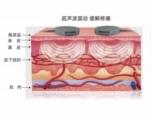 超声药物导入治疗仪皮层图.png