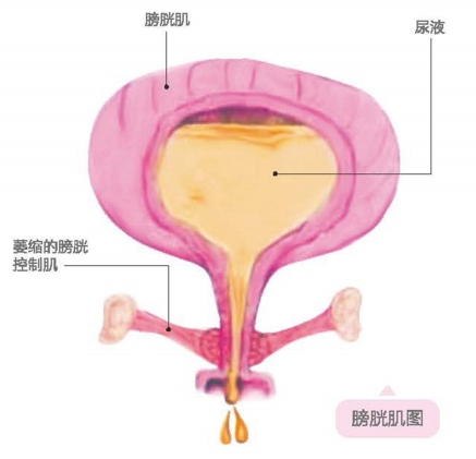 盆底肌康复治疗仪