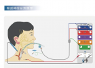 甲状腺手术中的喉返神经监测：IONM技术降低损伤风险