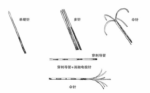 一次性射频消融电极针