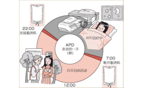 腹膜透析机
